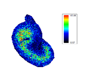 Colourful blob with a scale next to it indicating different regions.